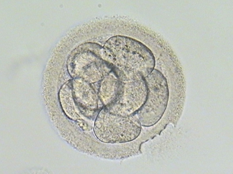 鐳射胚胎孵育術 (L-AH)