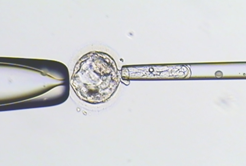 胚胎著床前染色體篩檢 (PGS)